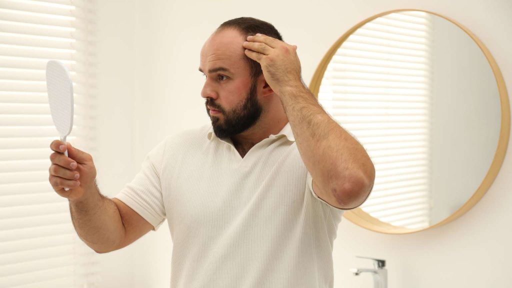 Hombre preocupado por la caída del cabello se observa al espejo antes de decidirse por una cirugía capilar.