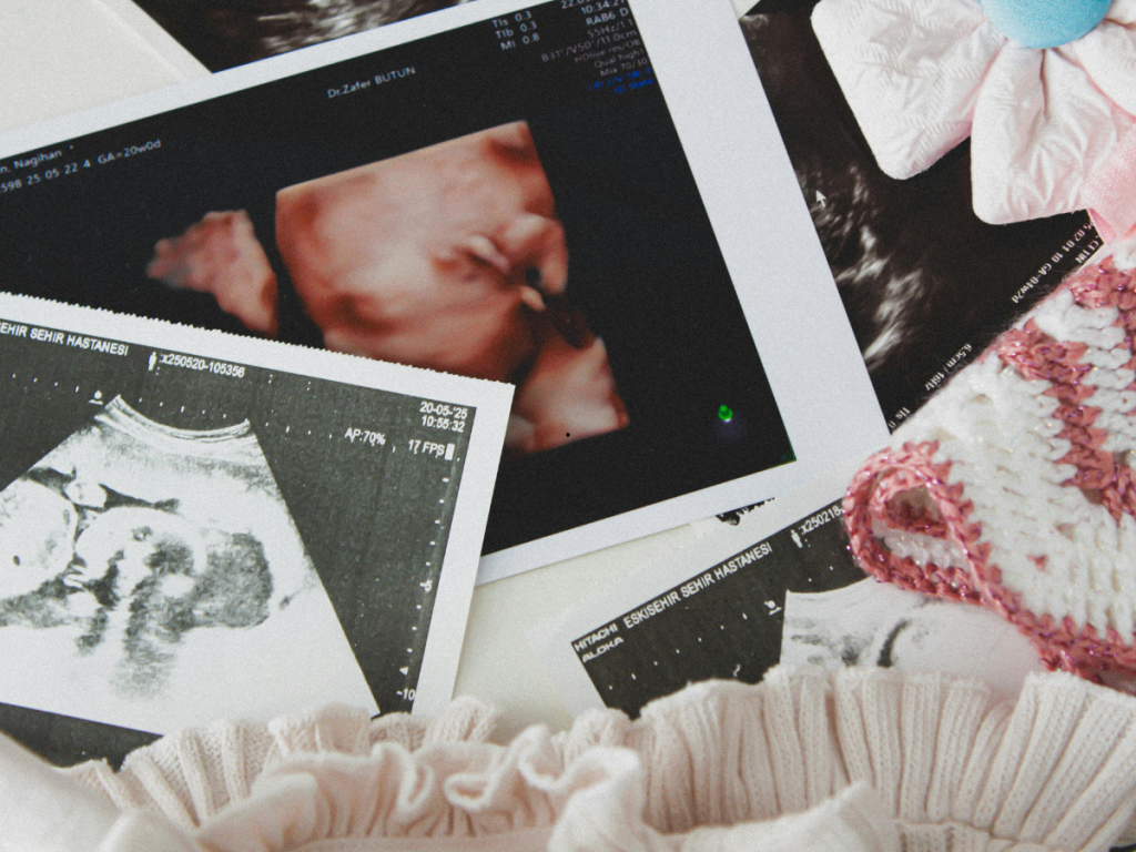 La maternidad consciente avanza gracias a la ecografía prenatal