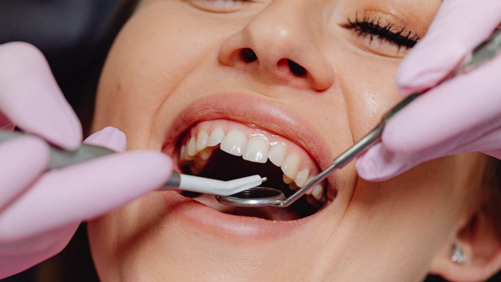 Ortodoncia estética en clínica odontológica de Pontevedra